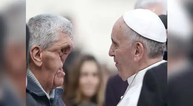 Papa Francisco abraza a hombre con el rostro desfigurado Papa Francisco abraza a hombre con el rostro desfigurado