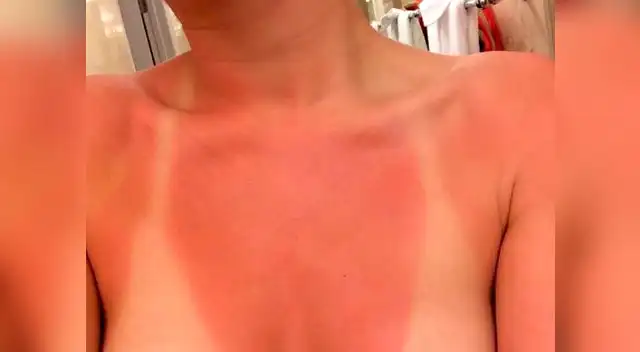 Miley Cyrus son selfie de su pecho insolado