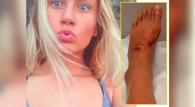 Kirra-Belle Olsson, surfista de 13 años, muestra en Facebook fotos de cómo quedó tras ataque de tiburón Kirra-Belle Olsson, surfista de 13 años, muestra en Facebook fotos de cómo quedó tras ataque de tiburón