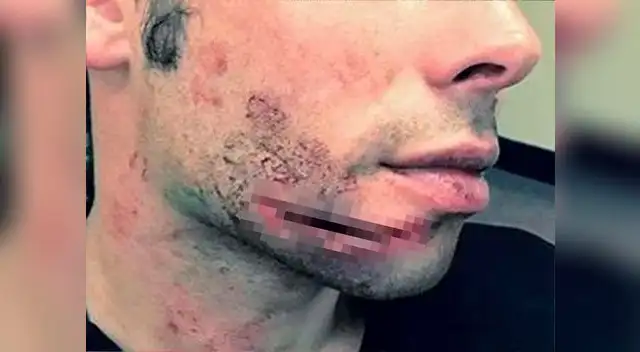 El corte de Gary mide 6 centímetros de longitud y necesitó 30 puntos.