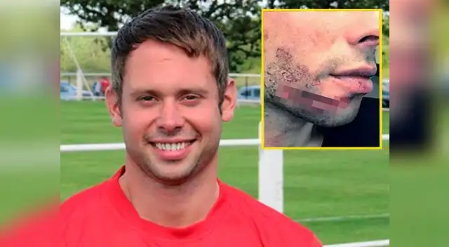 Gary Fawcett recibió terrible corte en la cara tras 'taco afilado' de su rival