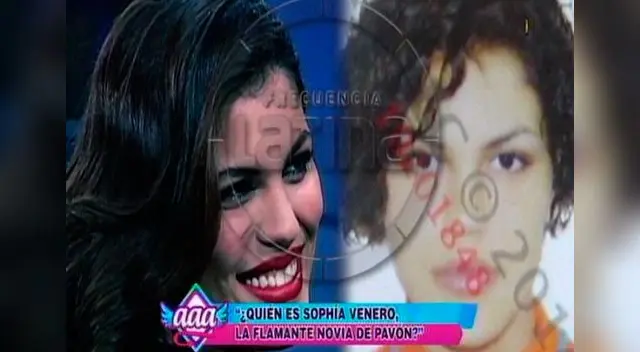 El antes y después de Sophia Venero. El antes y después de Sophia Venero.
