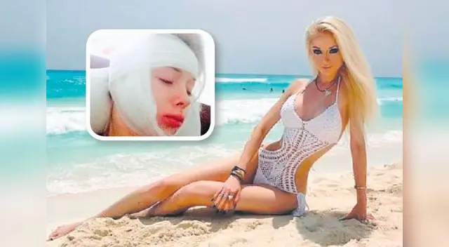 Golpes le generaron severo daños a modelo.