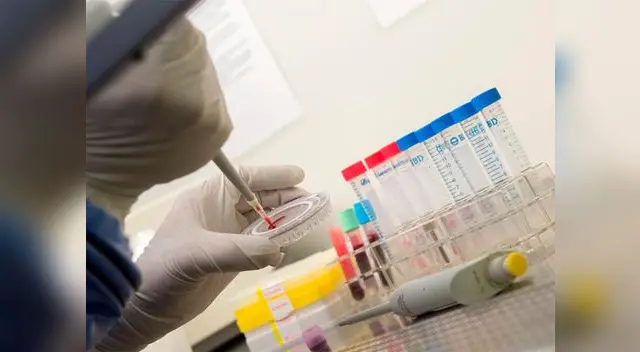 Prueban en Guinea test para diagnosticar ébola en 15 minutos.