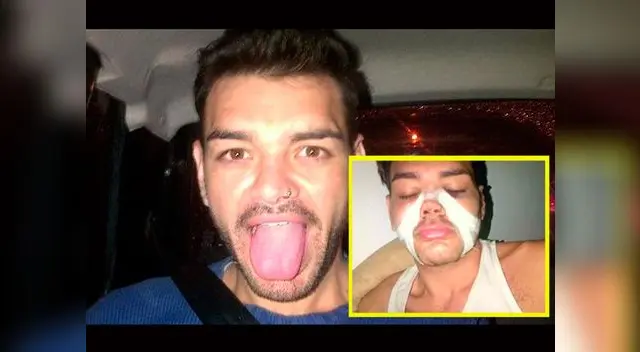 Fran Mariano se ha sometido a varias intervenciones para parecerse a Ricky Martin.