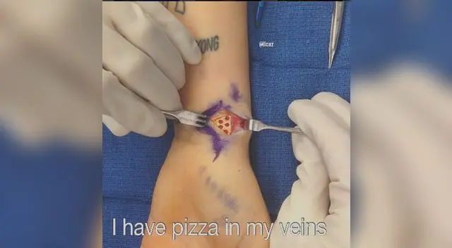 Miley Cyrus tiene una profunda herida. Miley Cyrus tiene una profunda herida.