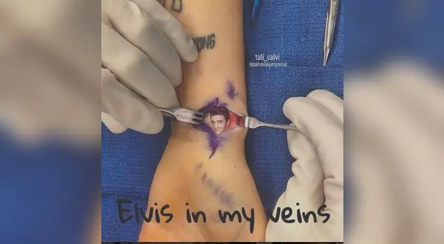 Miley Cyrus tiene una profunda herida. Miley Cyrus tiene una profunda herida.