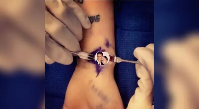 Miley Cyrus tiene una profunda herida. Miley Cyrus tiene una profunda herida.