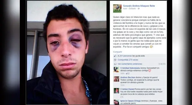 Chileno denunció que sufrió agresión por parte de su ex. 