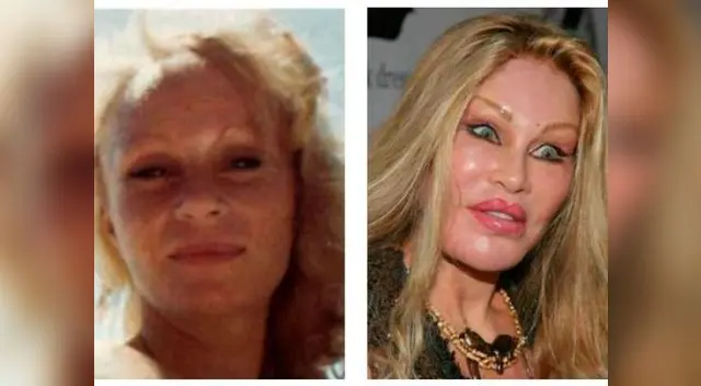 Jocelyn Wildenstein
