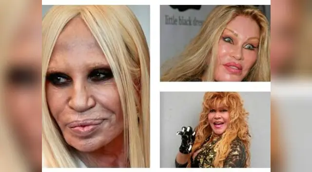 Bellos rostros arruinados por la cirugía