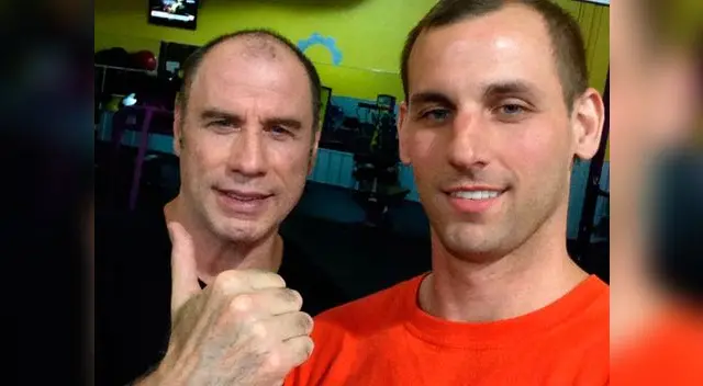 Tiene muy poco cabello. Tiene muy poco cabello.