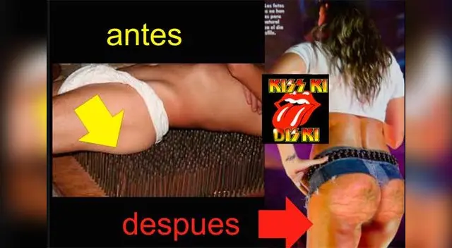 Memes de celulitis de Tilsa Lozano. 