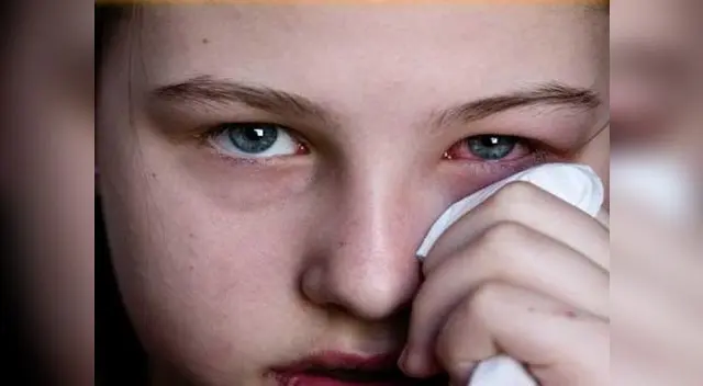 Toma nota: La conjuntivitis en recién nacidos puede ser causada por una infección, irritación o un conducto lagrimal obstruido. Llévalo al médico. Toma nota: La conjuntivitis en recién nacidos puede ser causada por una infección, irritación o un conducto lagrimal obstruido. Llévalo al médico.