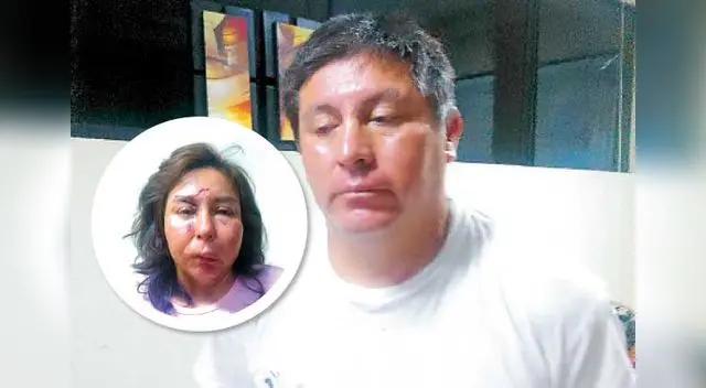 La mujer quedó con el rostro hinchado, el agresor en la comisaría. La mujer quedó con el rostro hinchado, el agresor en la comisaría.