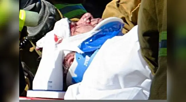 Así quedó la cabeza de Harrison Ford. 