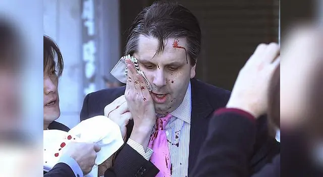 Fue un corte rápido y profundo. Fue un corte rápido y profundo.