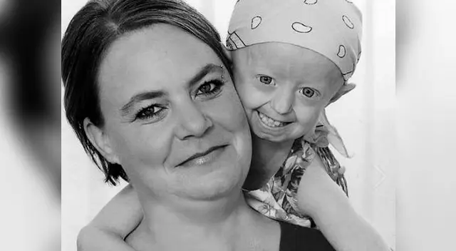 Hayley Okines y su madre. Ya descansa en paz. 