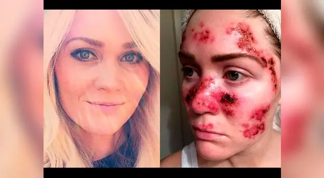 Su dura batalla la puso como ejemplo para otros