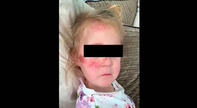 La niña quedó con graves heridas