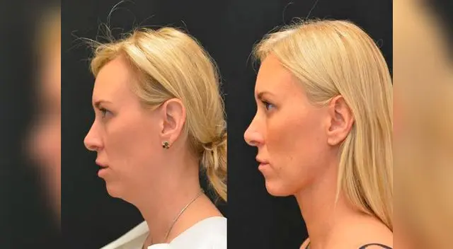 El poder de las operaciones estéticas