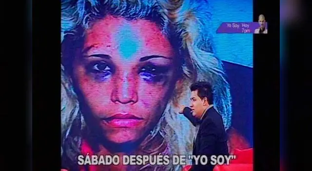 Ronny García niega haberle roto la nariz a Lady Guillén. 