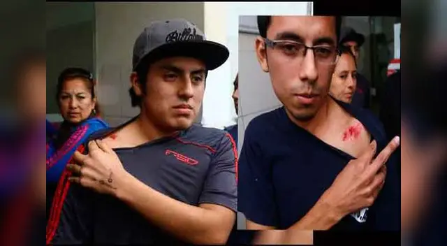 Heridos fueron trasladados al hospital Sergio Bernales, donde se recuperan. Heridos fueron trasladados al hospital Sergio Bernales, donde se recuperan.