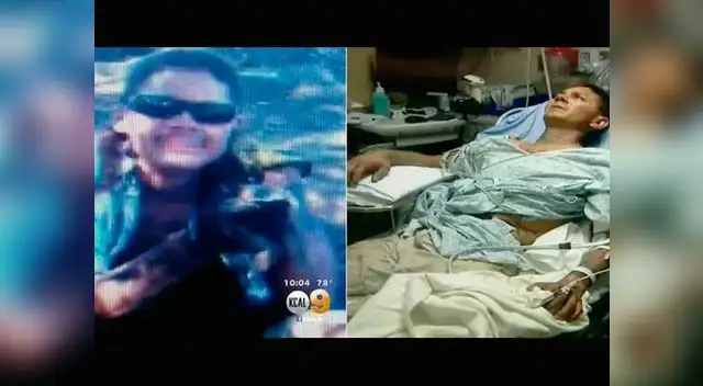 Álex Gómez. Su antes y después de ser mordido.