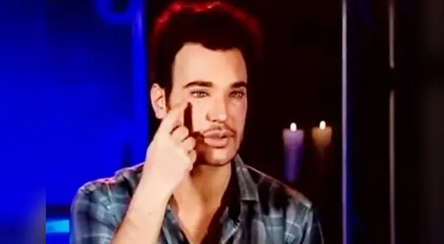 David Bisbal italiano contó la razón de su raro rostro. David Bisbal italiano contó la razón de su raro rostro.