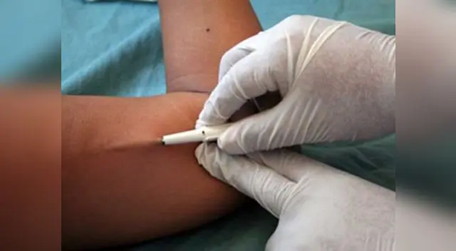 Este método es uno de lo más modernos que existe en el mercado.