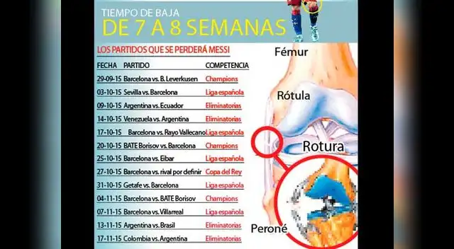 Lesión de ligamento lateral. Lesión de ligamento lateral.