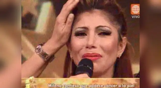 Milena sostuvo que tiene que someterse siempre a tratamiento para contener el cáncer de piel.