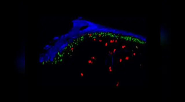 Los vídeos, que fueron registraron por los médicos, mostraron cómo el VIH se acopló a células propias de nódulos linfáticos Los vídeos, que fueron registraron por los médicos, mostraron cómo el VIH se acopló a células propias de nódulos linfáticos