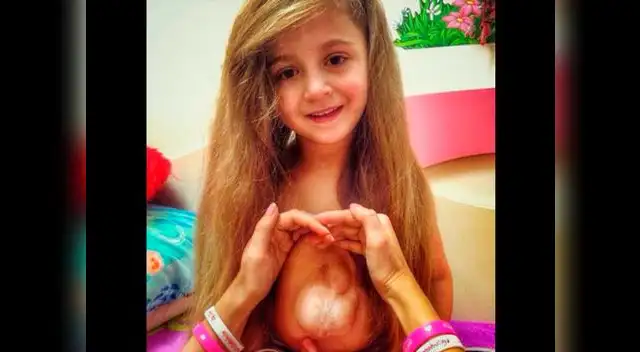 La menor dice amar su corazón pese a extraña condición anatómica. La menor dice amar su corazón pese a extraña condición anatómica.