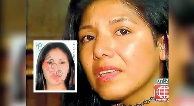 Mujer tiene problemas para caminar. Mujer tiene problemas para caminar.