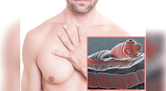 Primer caso en el mundo de cáncer 'no humano'. Primer caso en el mundo de cáncer 'no humano'.