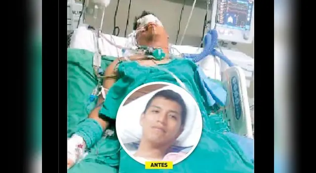 Así se encuentra actualmente el marino postrado en una cama.