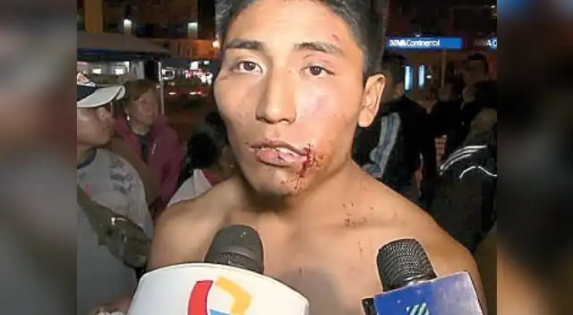 Alcalde negó que serenos hayan usado machete de cocina para atacar. Alcalde negó que serenos hayan usado machete de cocina para atacar.