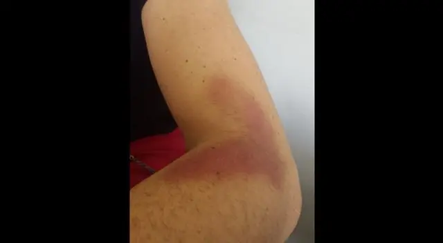 Jurado del reality quedó mal herido. Jurado del reality quedó mal herido.