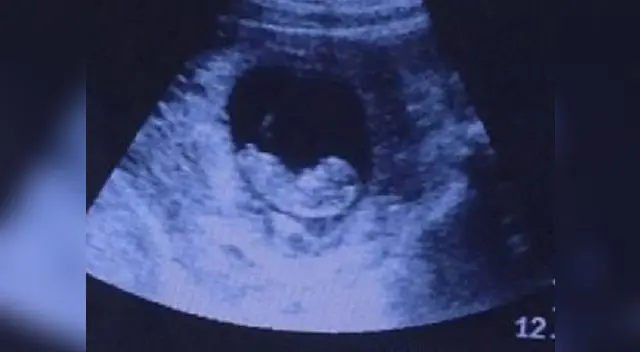 Insólita imagen fue publicada en sitio web imgur.