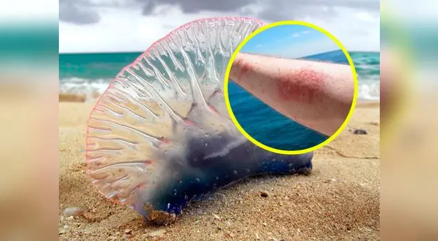 El verano en Lima se inició con brote de medusas. El verano en Lima se inició con brote de medusas.