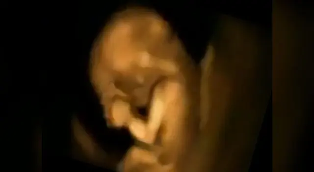 Baila en el vientre de su madre y se vuelve viral. Baila en el vientre de su madre y se vuelve viral.