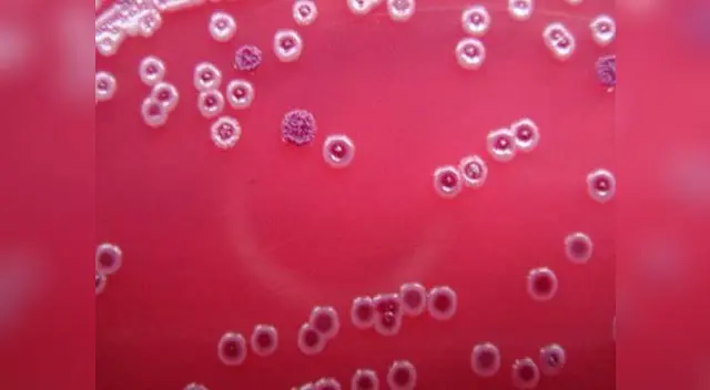 La enfermedad que podría acabar con la raza humana.