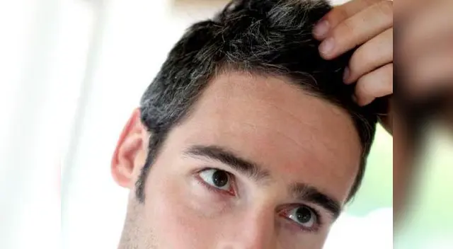 Las canas también aparecen en los jóvenes. Las canas también aparecen en los jóvenes.