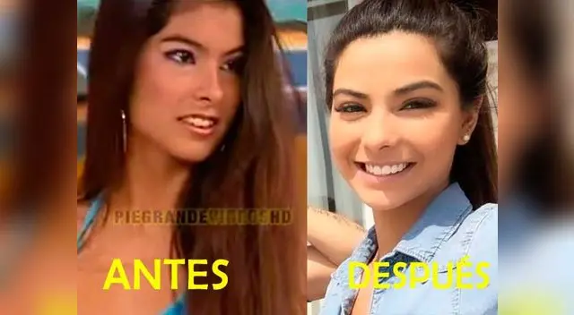 Ivana Yturbe (su antes y después).
