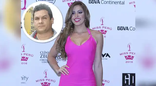 Milett Figueroa aún no se recupera de la alergia de su piel