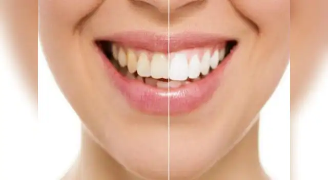 Cuidado con el consumo de gaseosas. Cuidado con el consumo de gaseosas.