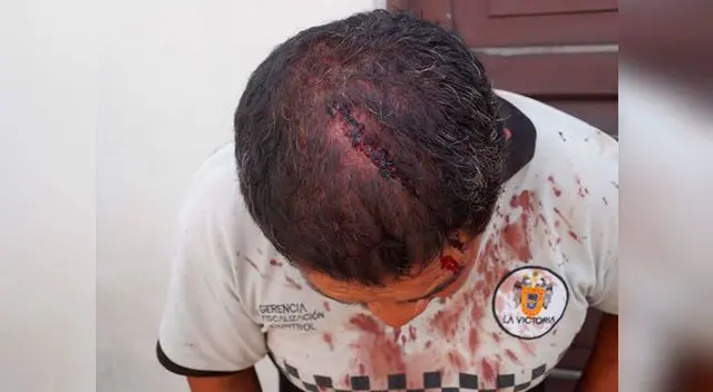 Médicos tuvieron que aplicarle varios puntos para cerrarle la herida
