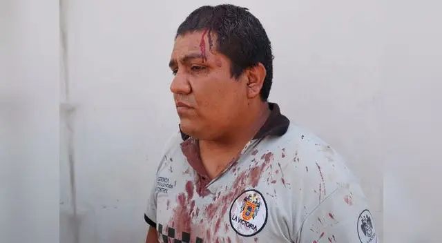 Policía Municipal fue víctima de cobarde agresión cuando realizaba su labor