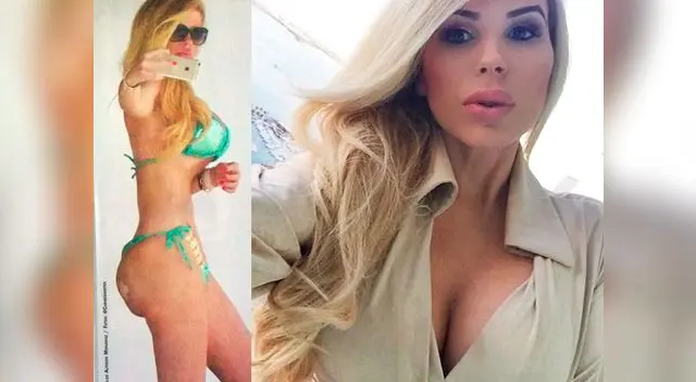 Un especialista también habló de otras operaciones que se sometió la hija de Bozzo Un especialista también habló de otras operaciones que se sometió la hija de Bozzo